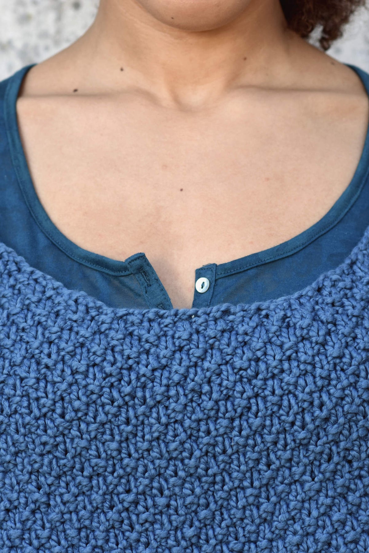 Top Artemis, Detail