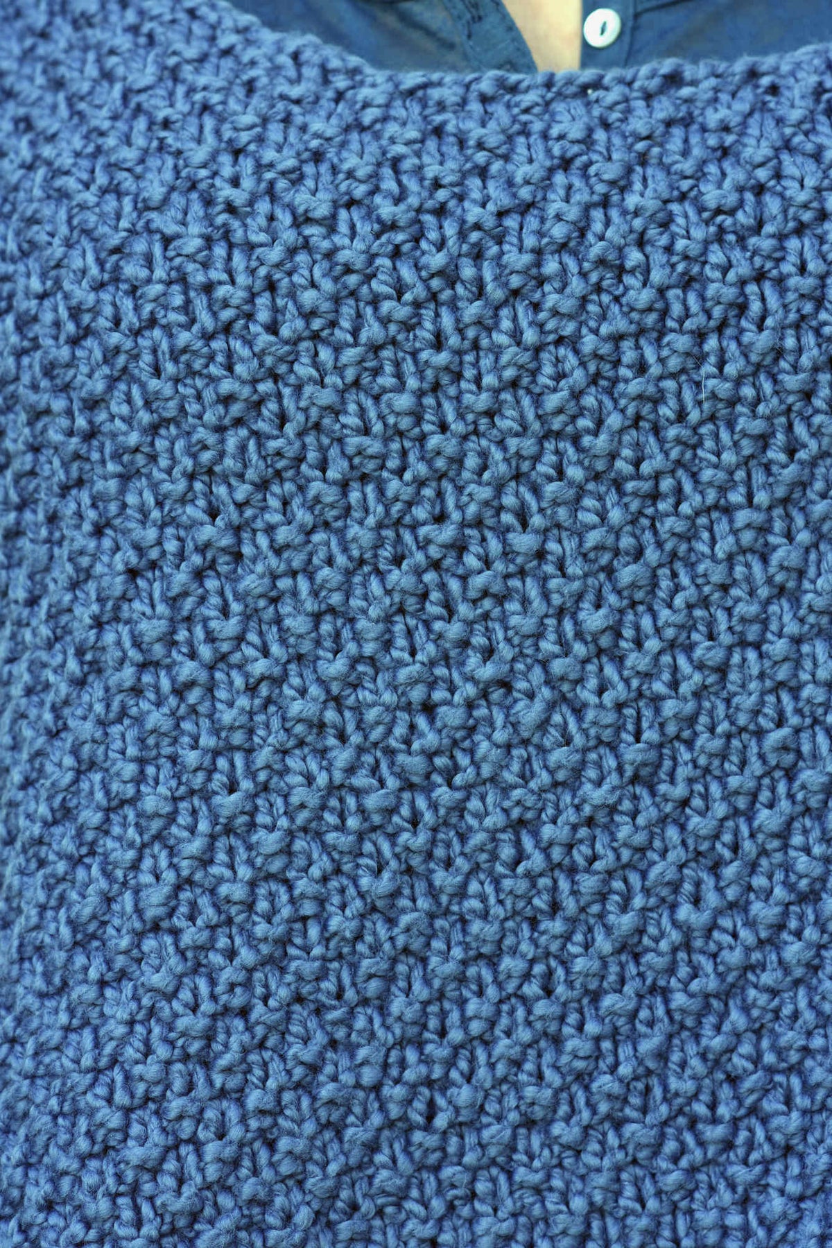 Top Artemis, Detail 2